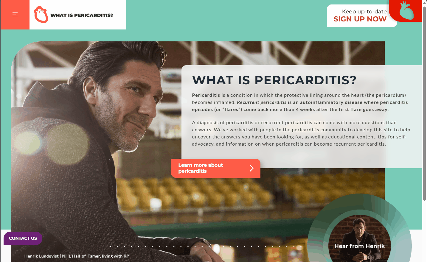 What Is Pericarditis?